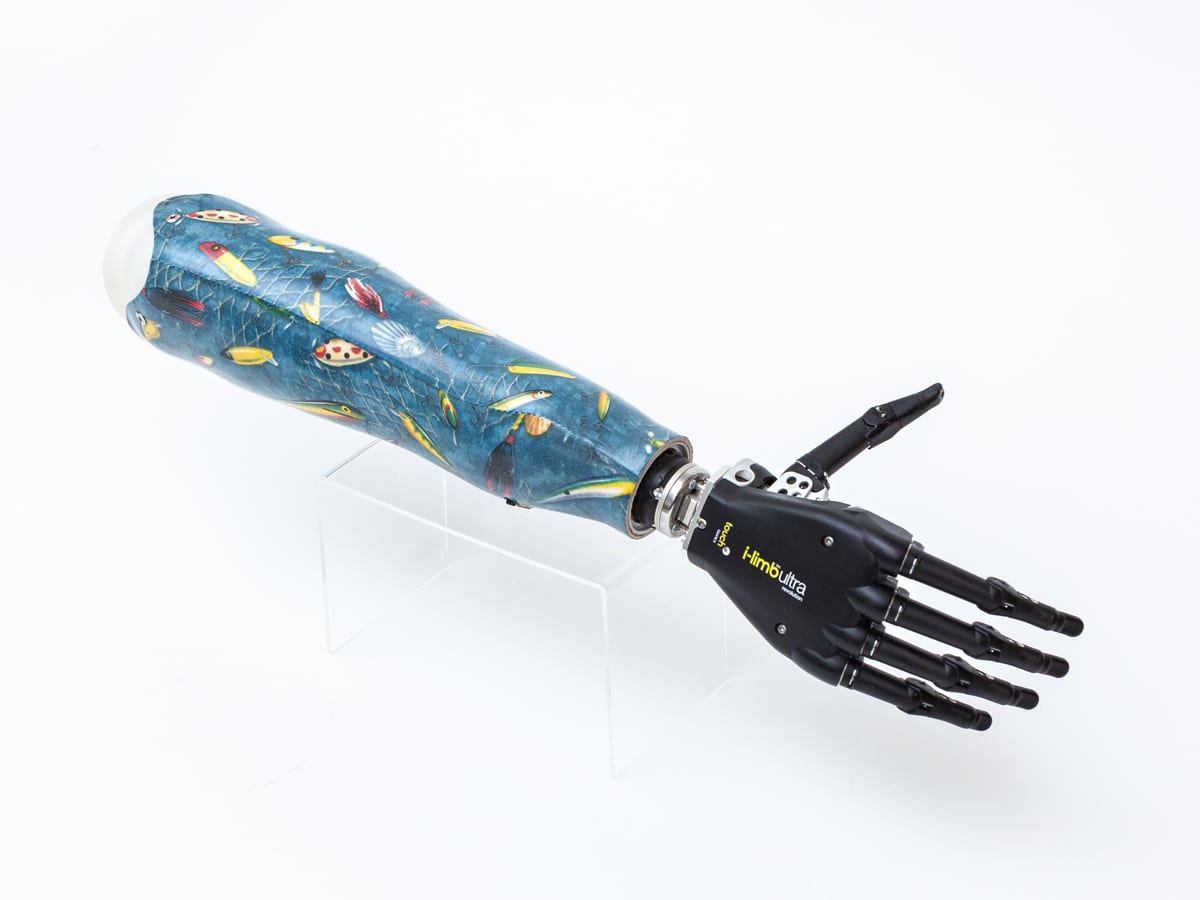 a black prosthetic hand with a colorful blue pattern